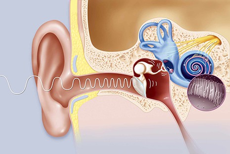 Các bệnh về tai làm giảm sức nghe của trẻ